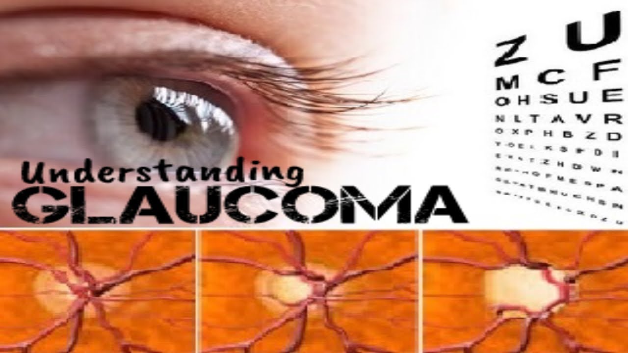 Understanding Glaucoma | Signs, Symptoms, Diagnosis & Treatment