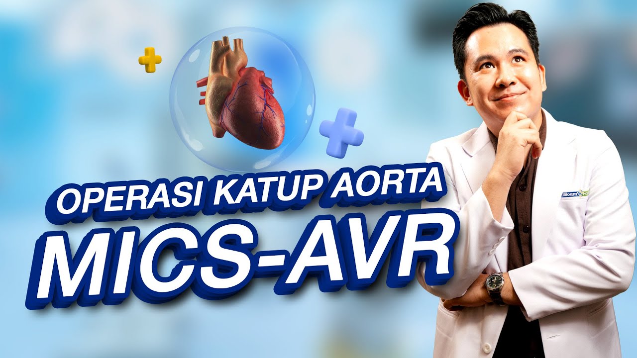 MICS-AVR: Operasi Katup Aorta Jantung Minimal Invasif!