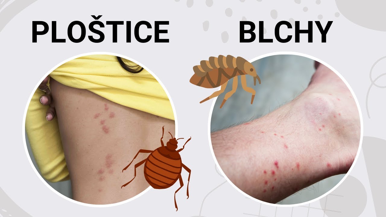 Ako identifikovať štípance od ploštice?