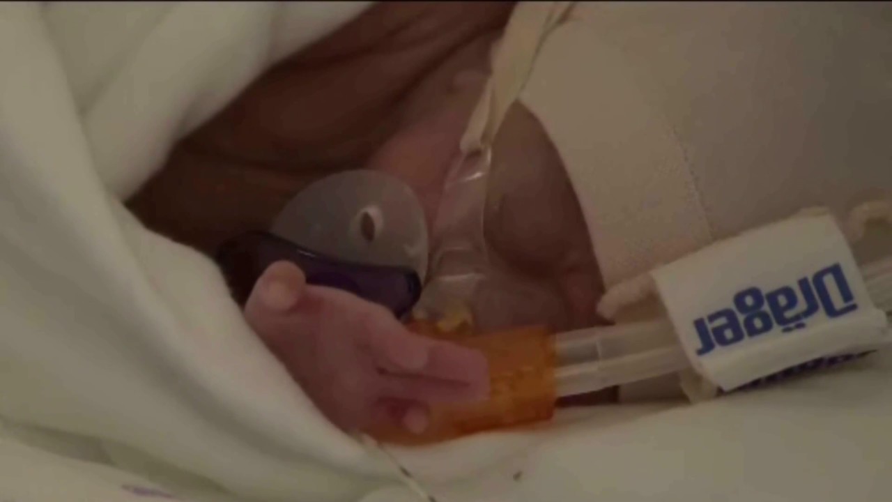 L'histoire de Léo, bébé prématuré.
