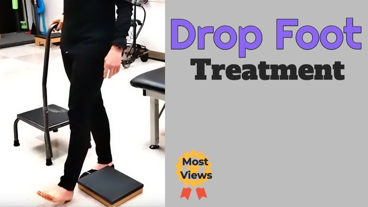 Foot Drop Treatment (no narrative)