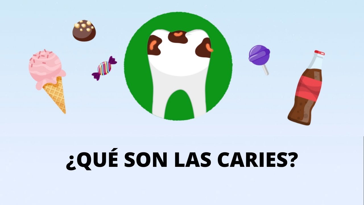 ¿Qué son las caries?