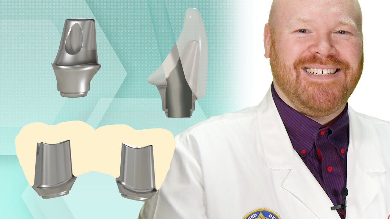 Non-Engaging Custom TruAbutment with Angled Screw Channel