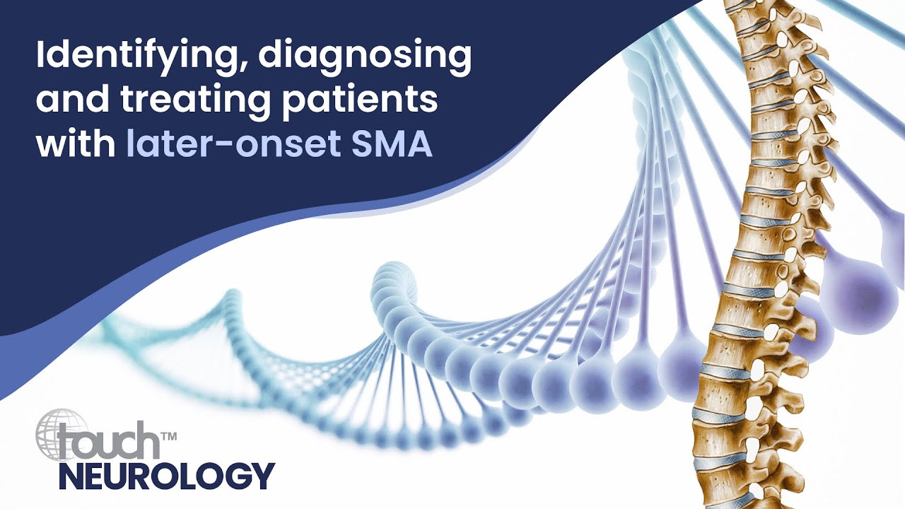 Identifying, diagnosing and treating patients with later-onset SMA