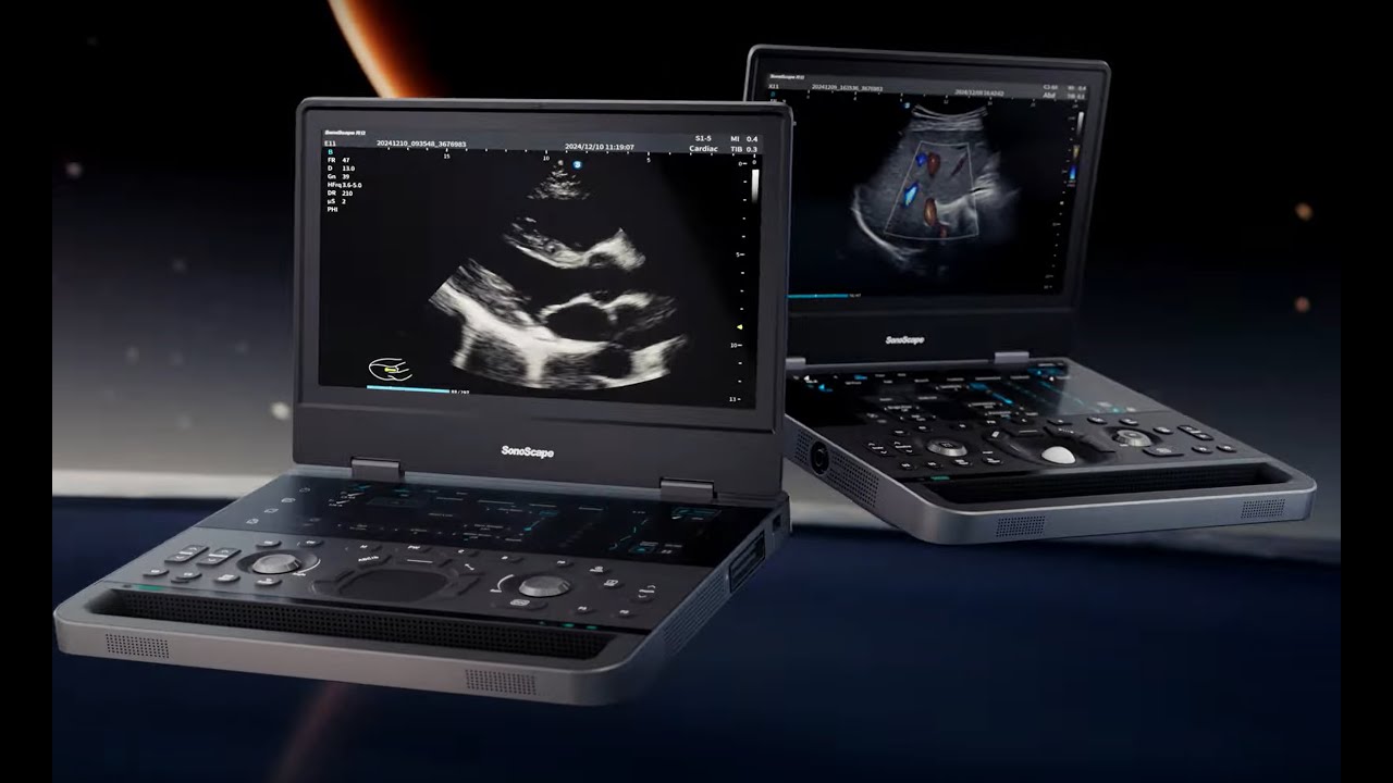 X11E11 New laptop ultrasound design