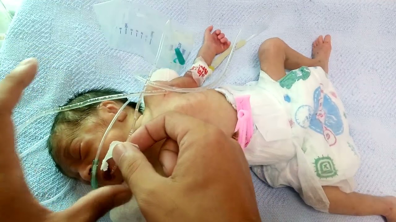 Preterm baby come to nicu oxygen dependent poor sucking poor reflex pray for cute baby #nicubaby 