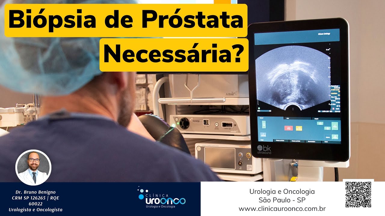 Quando &eacute; preciso fazer bi&oacute;psia de pr&oacute;stata para PSA alterado?