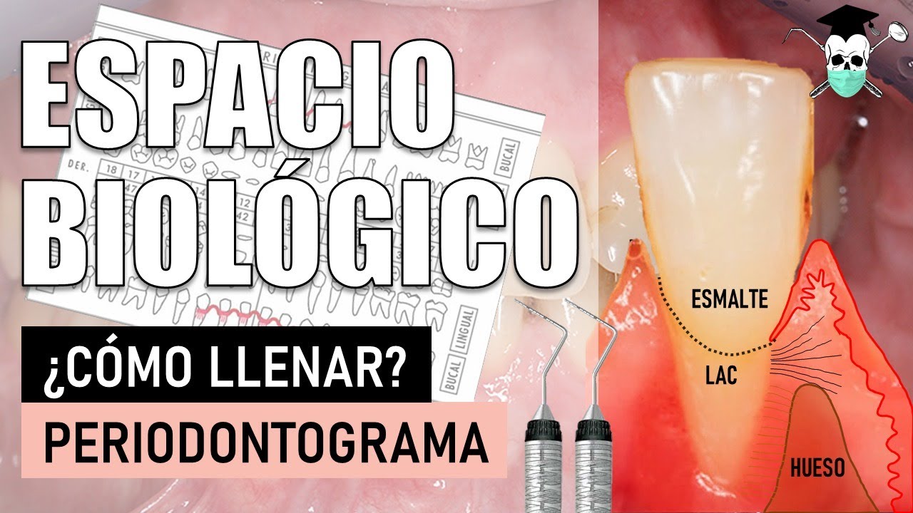 PERIODONTOGRAMA Paso a Paso *Espacio Biológico*