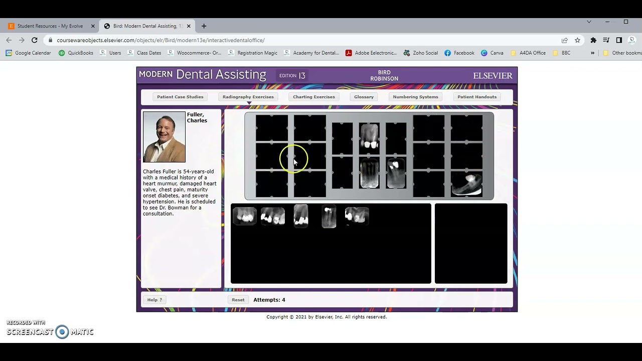 How to use Evolve Interactive Dental Office X-ray Mounting