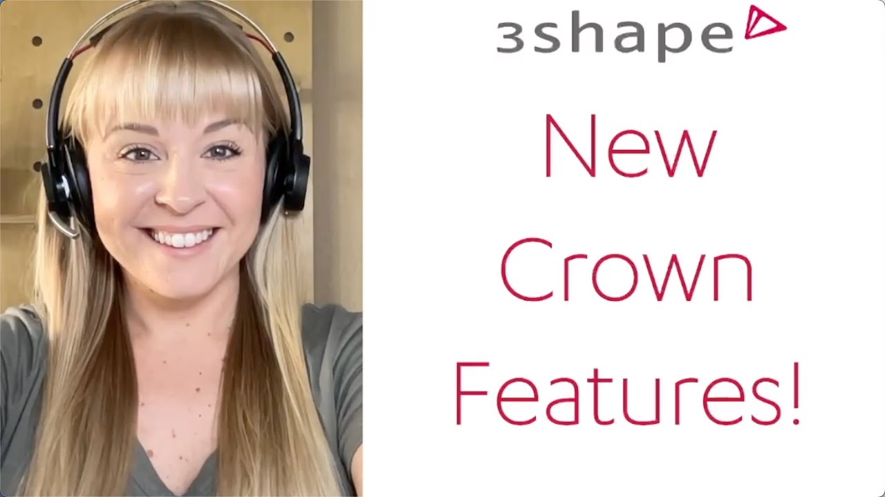 New Features on 3Shape Automate
