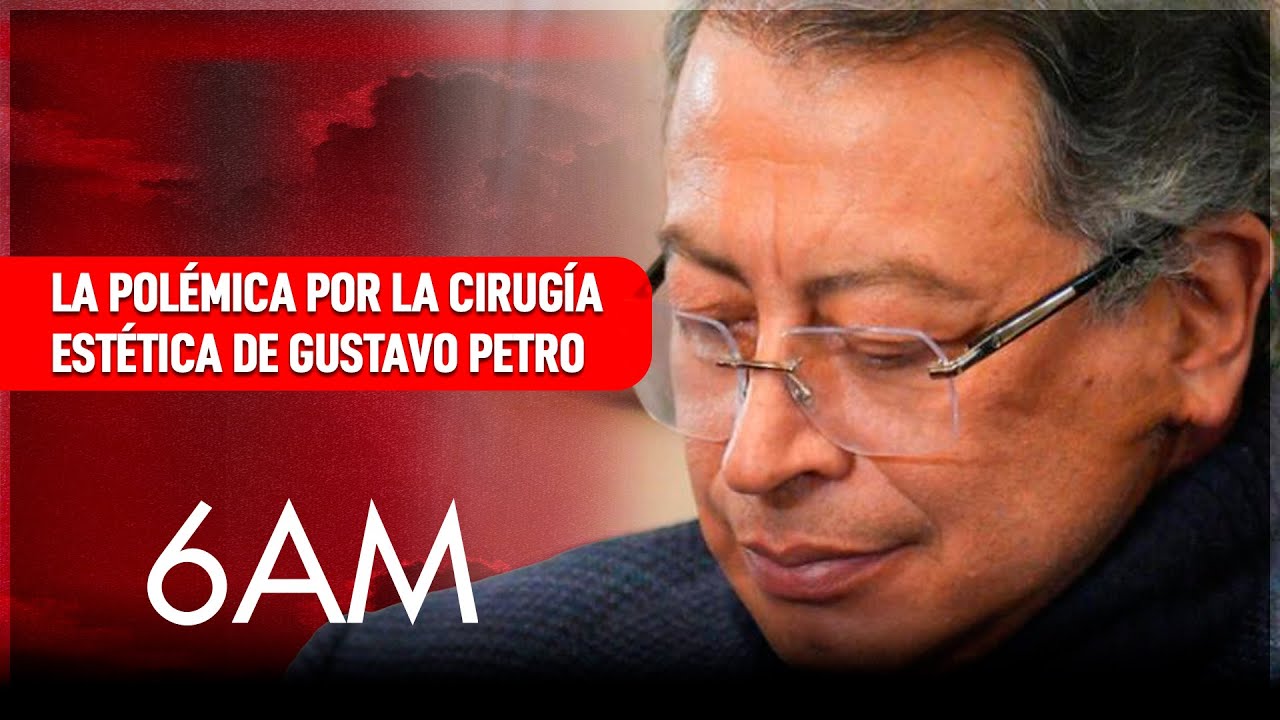 La polémica por la cirugía estética de Gustavo Petro y los riesgos a los que se enfrenta | 6AM