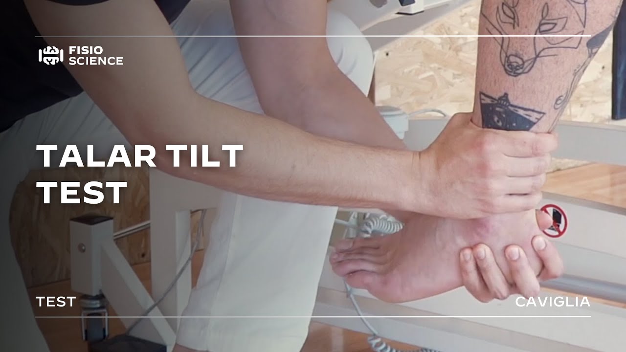 Talar Tilt Test | Distorsione di Caviglia
