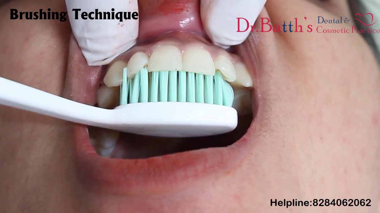 Best Dental Clinic Chandigarh Dr Batth's Dental How to brush your teeth