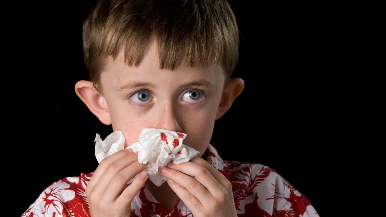 Nosebleeds - Akron Children's Hospital video