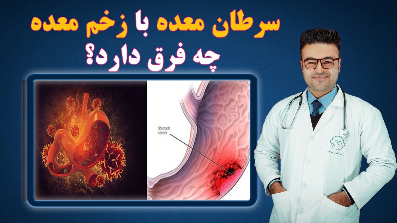 سرطان معده با زخم معده چه فرق دارد؟| داکتر قیس نیکزاد