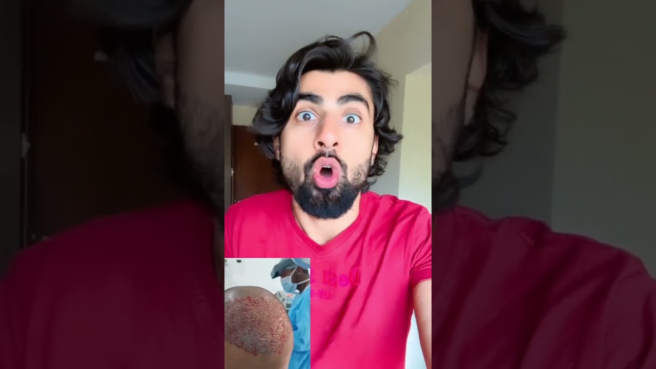 Celebrities Jinhone Karwaya Hair Transplant | Mridul Madhok
