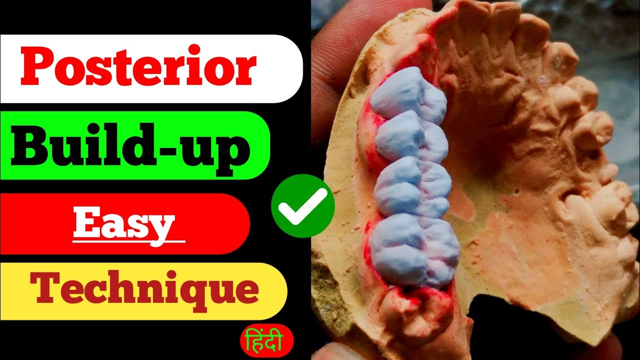 Posterior Build up Easy Technique|| Ceramic porcelain| Anatomy| Shofu| Dental Video| Teeth Making|