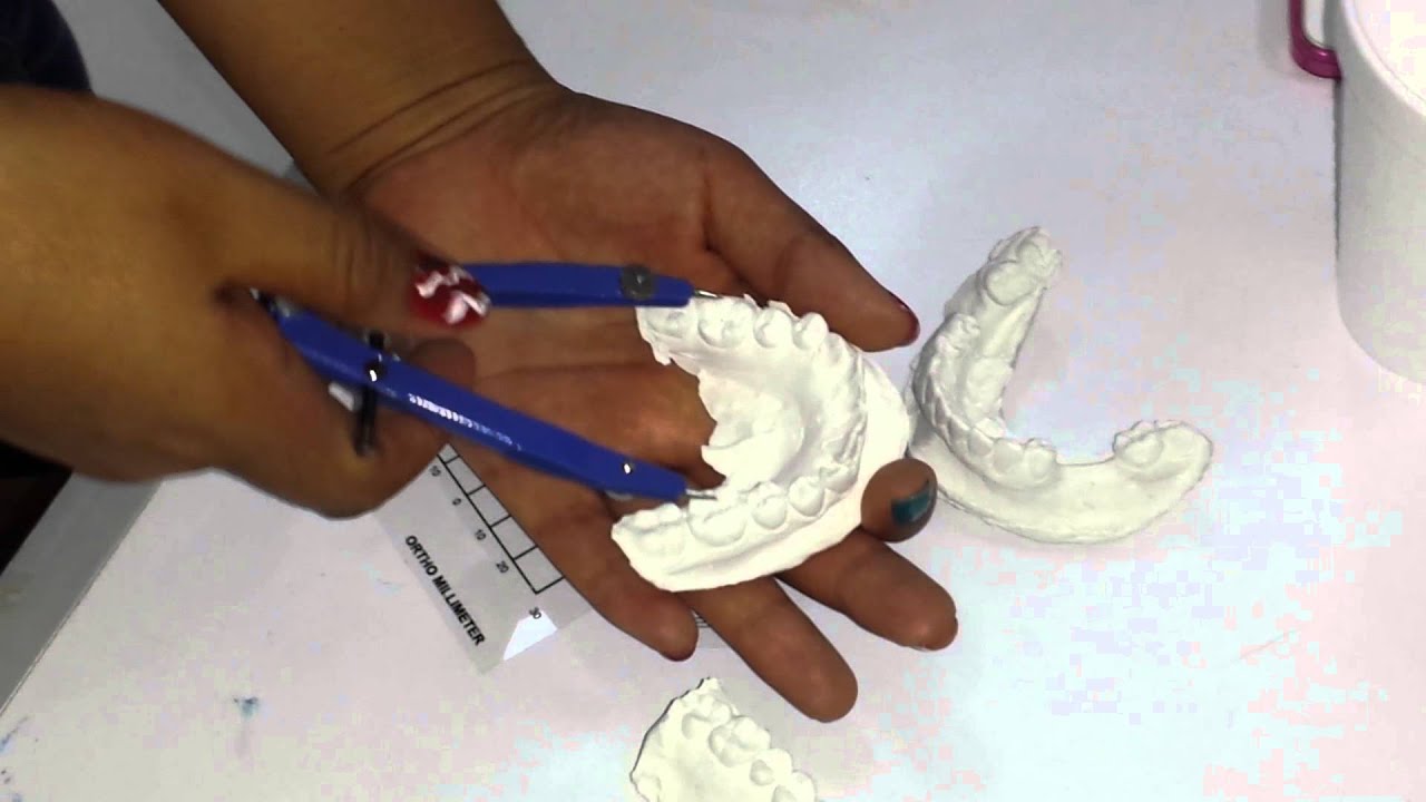 Analisis de Korkhaus