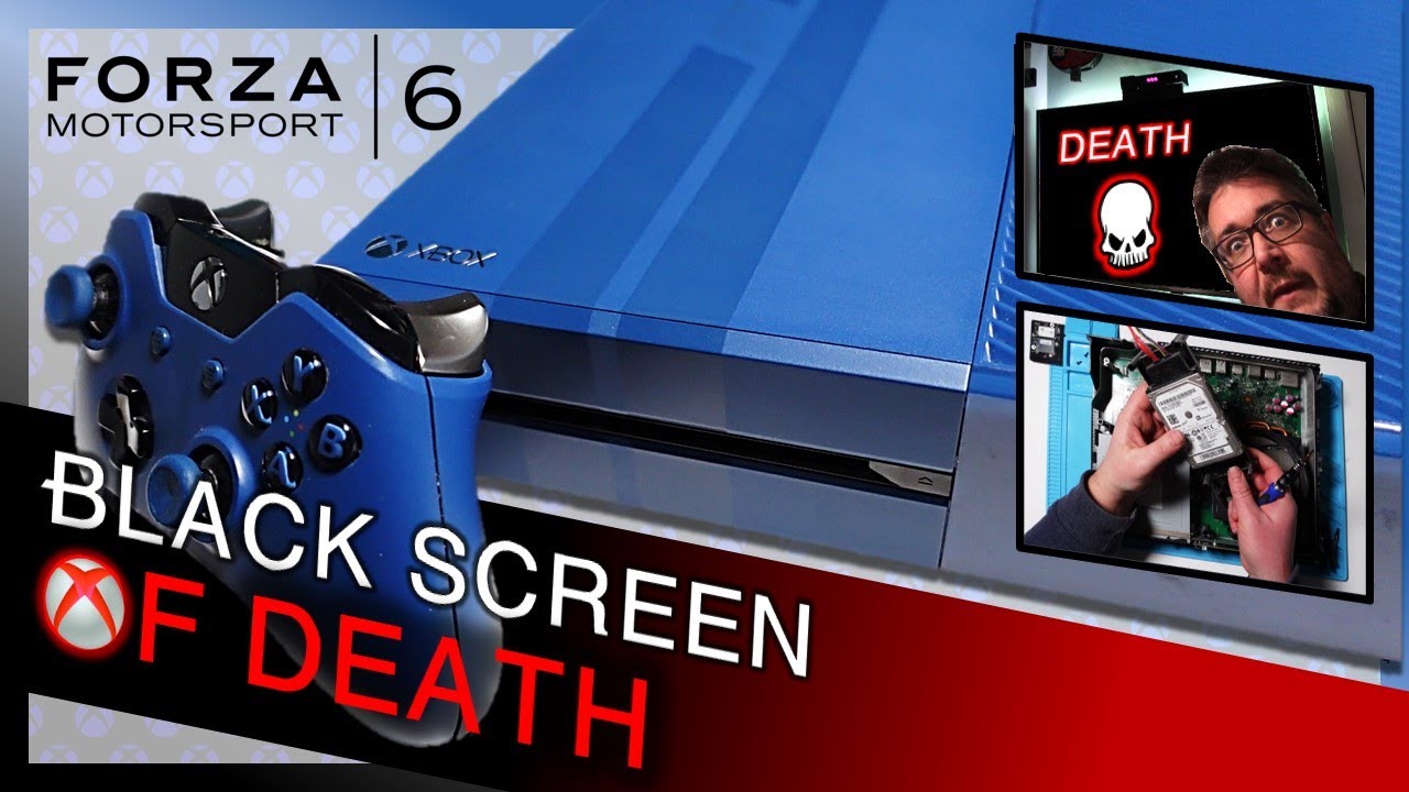 I bought a FORZA XBox One with the Black Screen Of DEATH | Can I FIX It?
