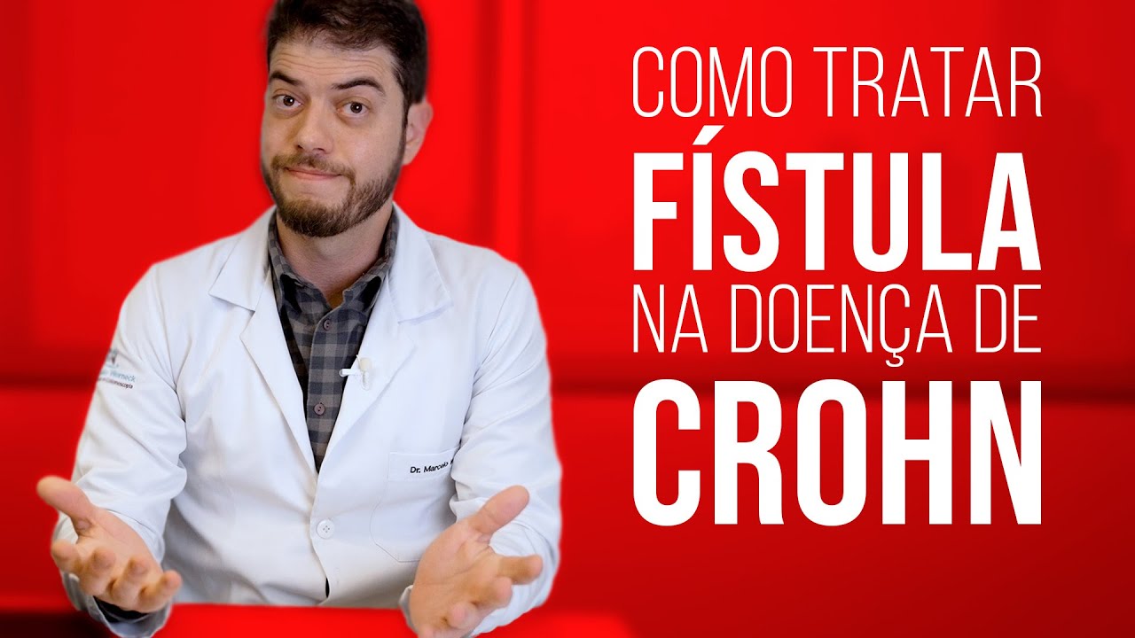 Como tratar Fístula na Doença de Crohn