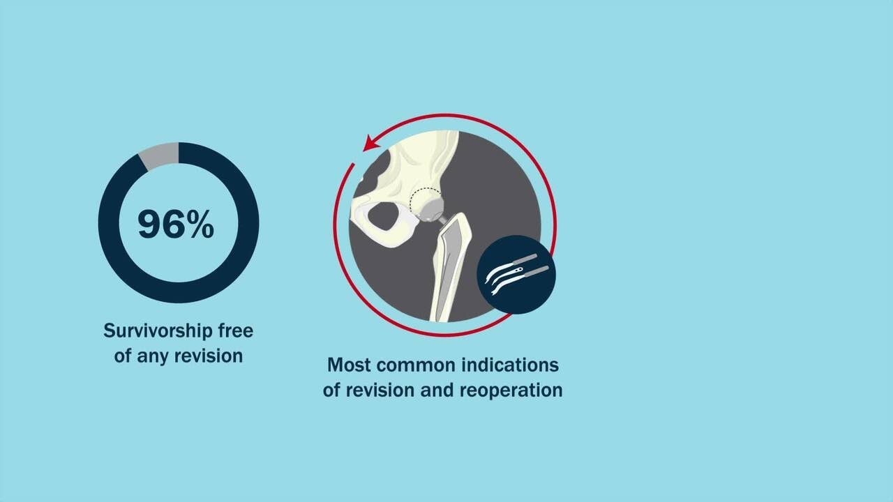 Outcomes Following Direct Anterior Approach Total Hip Arthroplasty