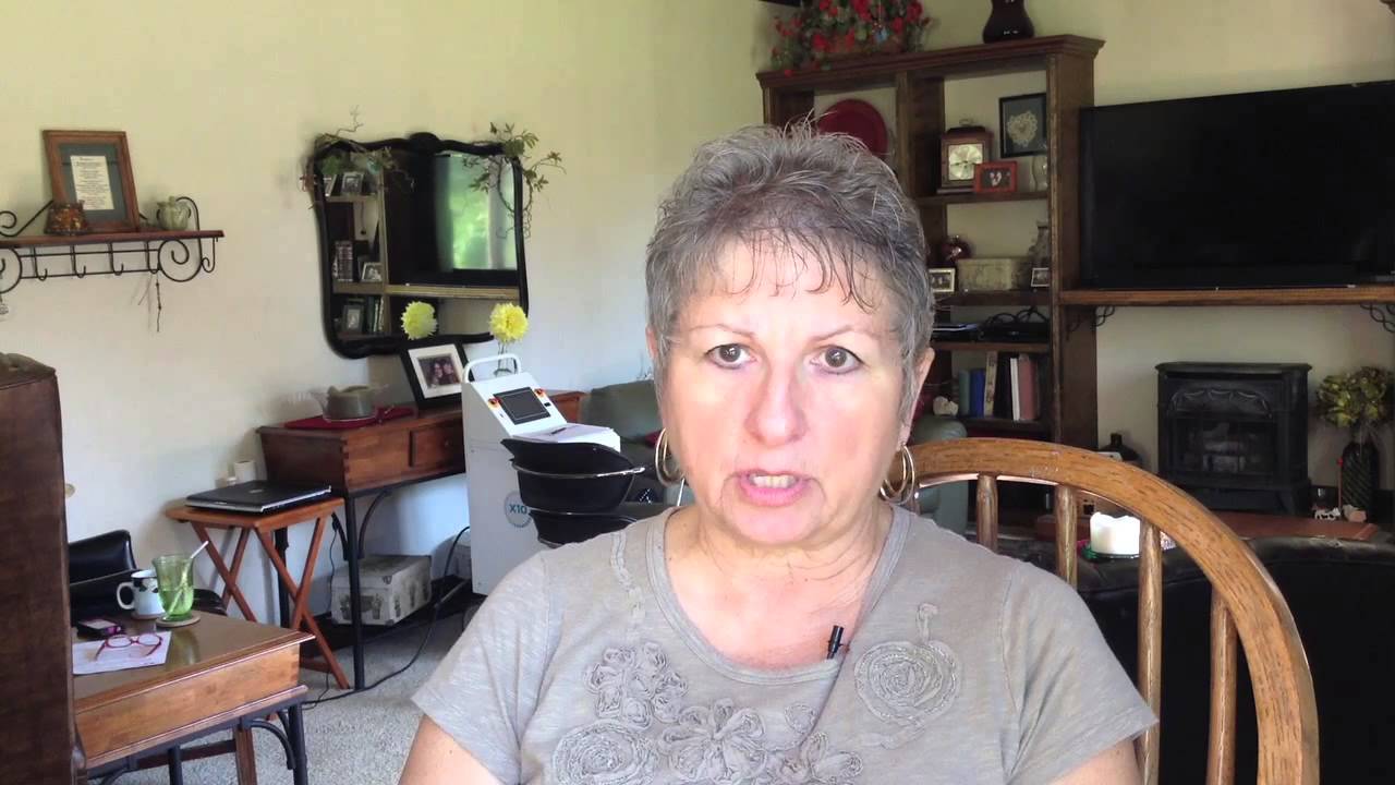 Bilateral Partial Knee Replacement (Debi's Story, Dr. Jeffrey DeClaire)