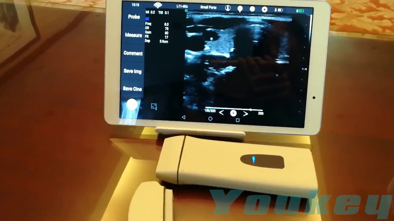 linear probe 1 with Android Tablet - detachable transducers with different terminal device.