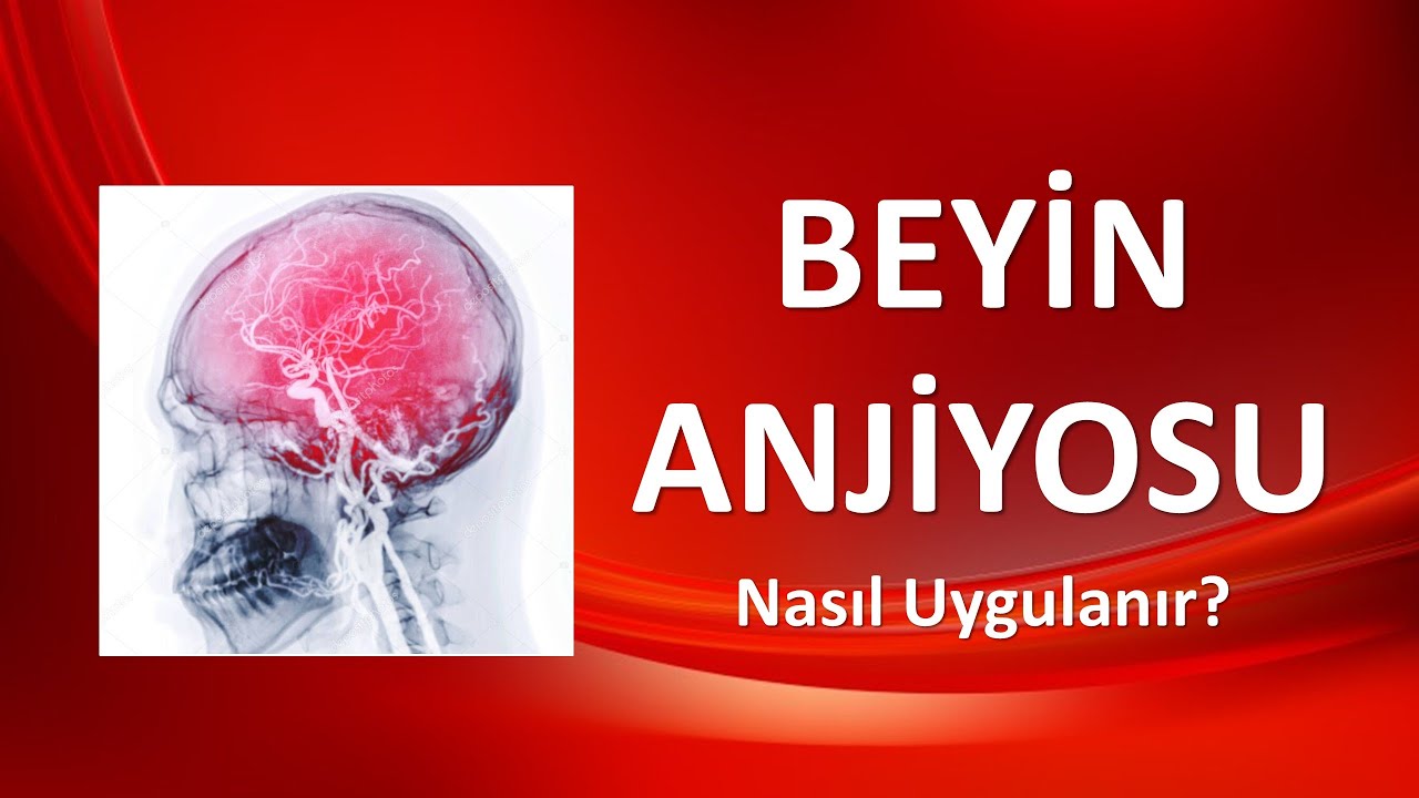 BEYİN ANJİYOSU Nasıl Uygulanır?