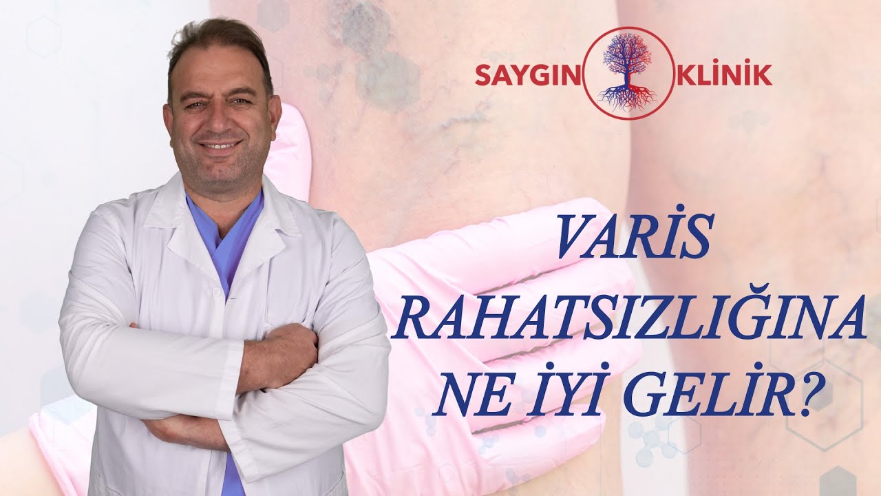 Varis Rahatsızlığına Ne İyi Gelir?