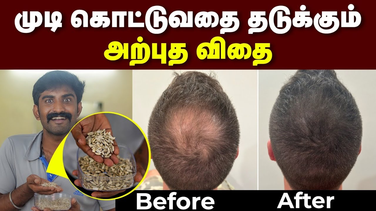 120 ரூபாய் செலவு பண்ணா போதும் | முடி கரு கருன்னு வளரும் 😍😍| Best seed for hair growth | Follicle.