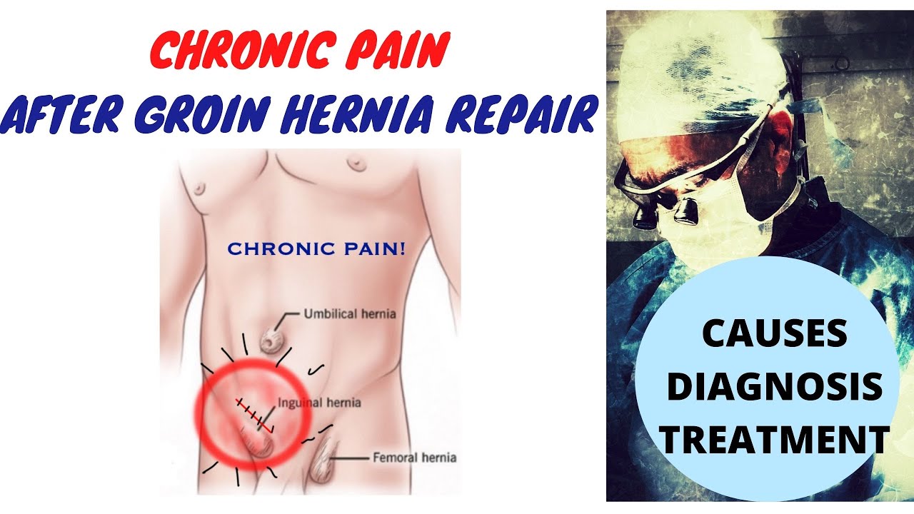 Chronic  Pain After Hernia Repair