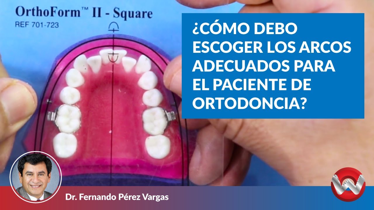 ¿Cómo Escoger los Arcos Adecuados para el Paciente de Ortodoncia?