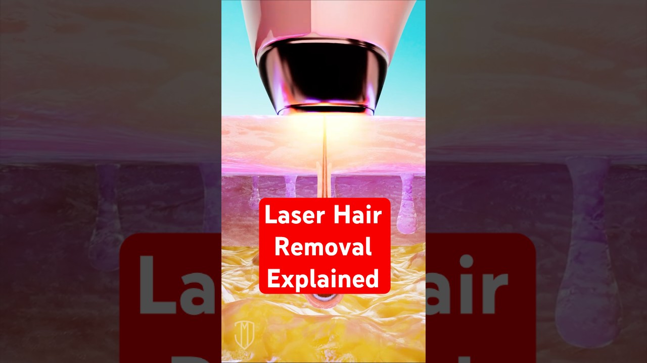 How Laser Hair Removal Works  #science #medical #dermatology #lifehacks #viralshorts
