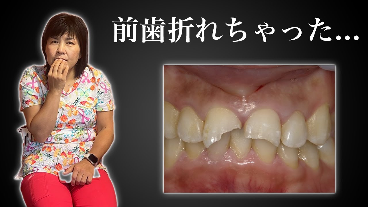 【最悪】この歯...バレないように治せますか...？
