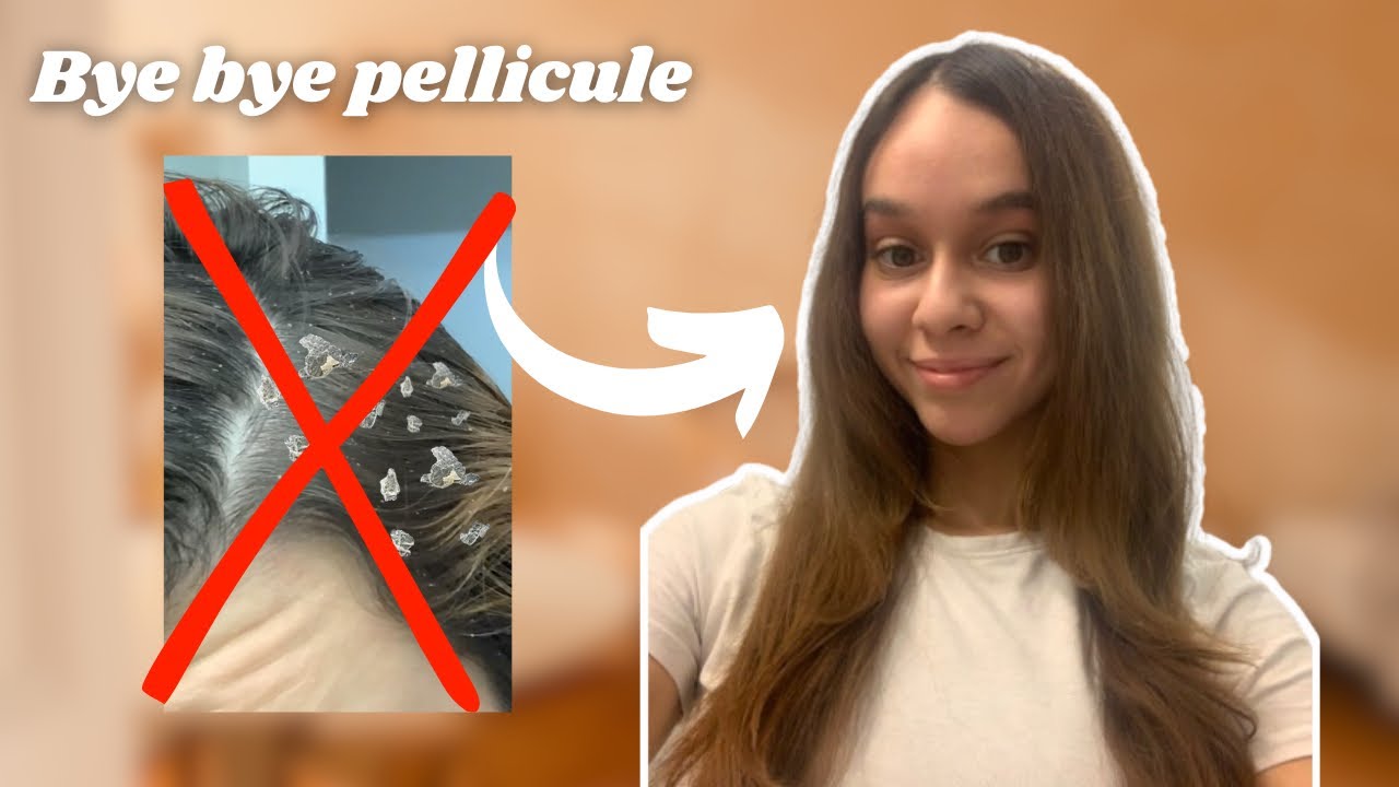 HAIR ROUTINE (bye bye pellicule et bonjour cheveux en santé)