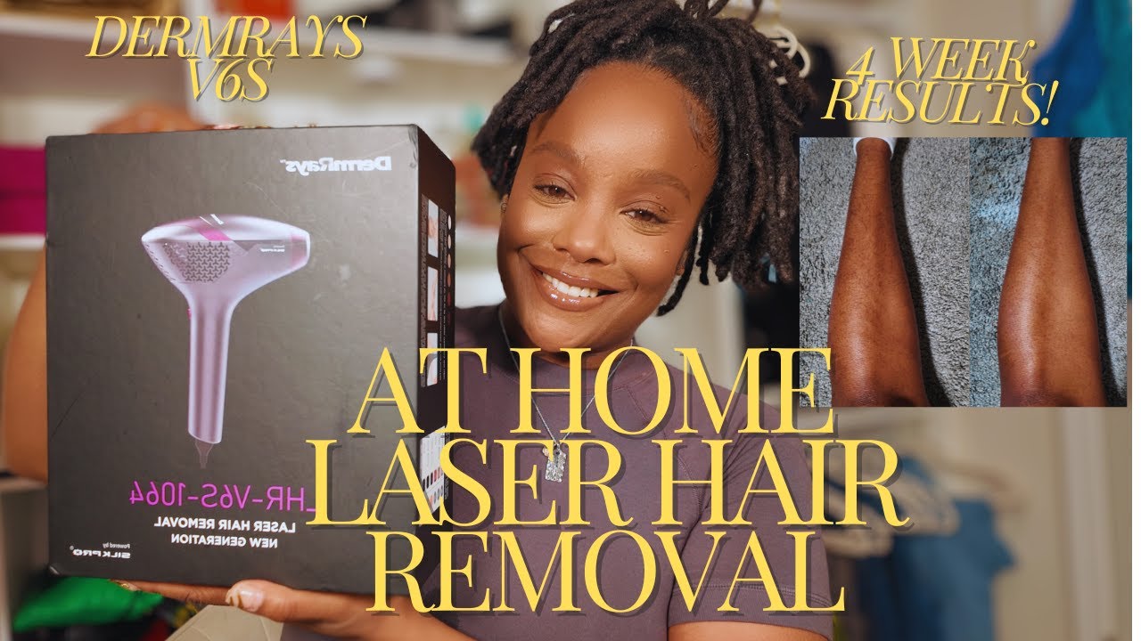 AT HOME LASER HAIR REMOVAL FOR MELANATED SKIN! DERMRAYS V6S REVIEW!