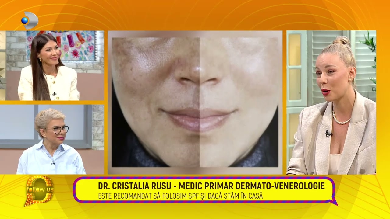 Follow us! - Petele pigmentare: tipuri, cauze si tratamente | Totul despre analiza faciala