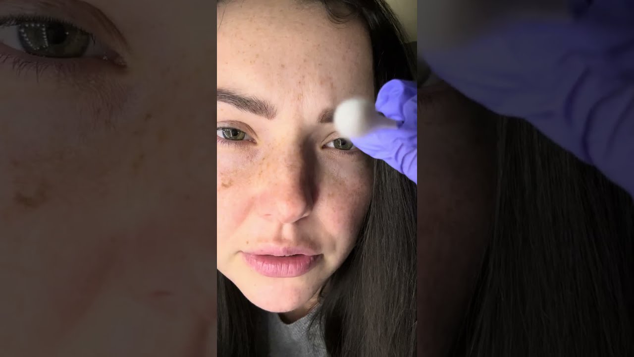 Quick skin examination ASMR (gum chewing , latex gloves)