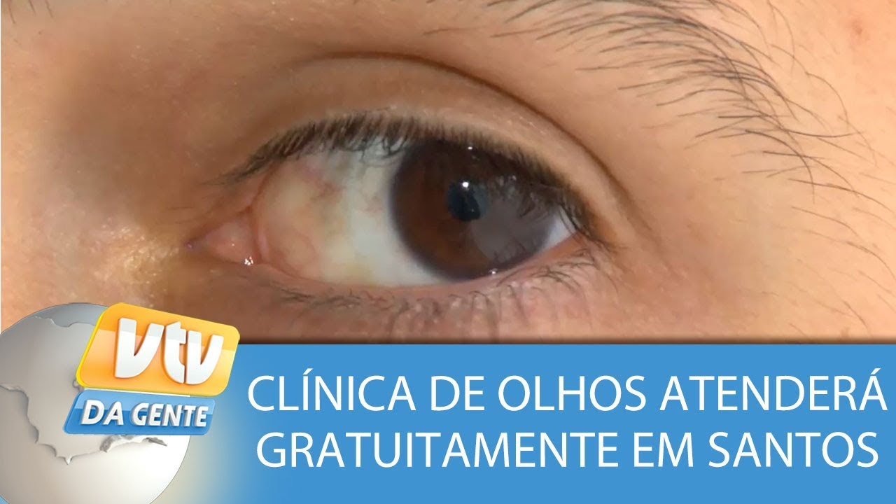 Cl&iacute;nica de olhos atender&aacute; gratuitamente em Santos