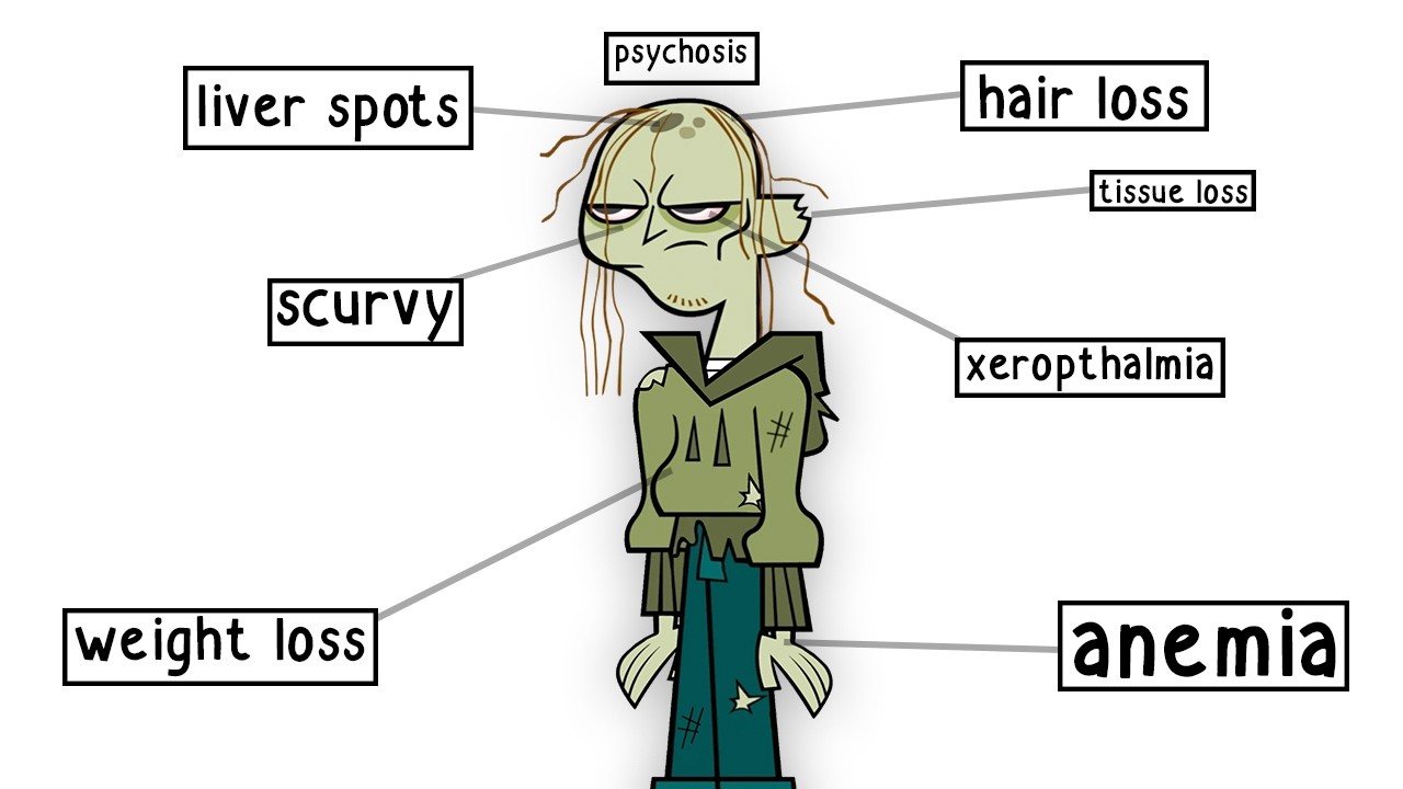 Что случилось с Иезекиилем? | Теория тотальной драмы