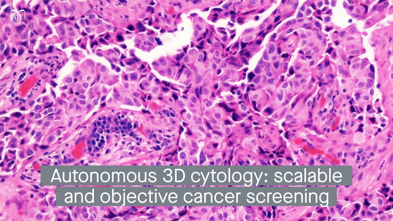 Clinically autonomous cytology via whole-slide edge tomography for scalable cancer screening