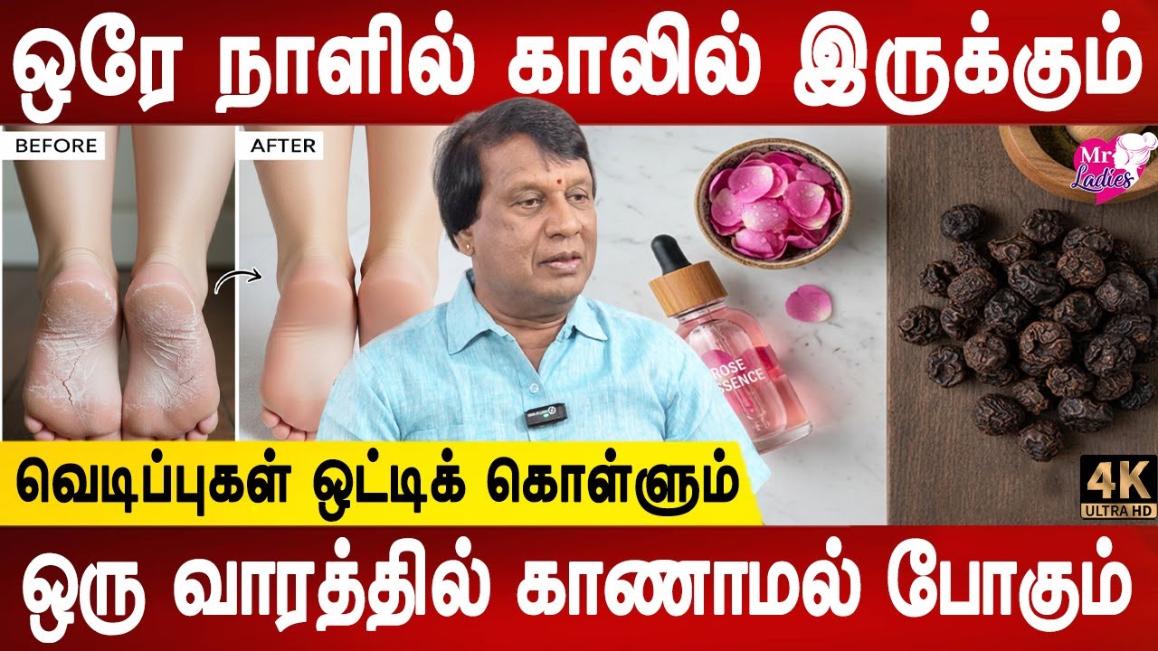 இதைப் போட்டு தூங்குங்கள் | Cracked Feet: Causes & Home Remedies | Patha vedippu | Dr.Anbuganapathi