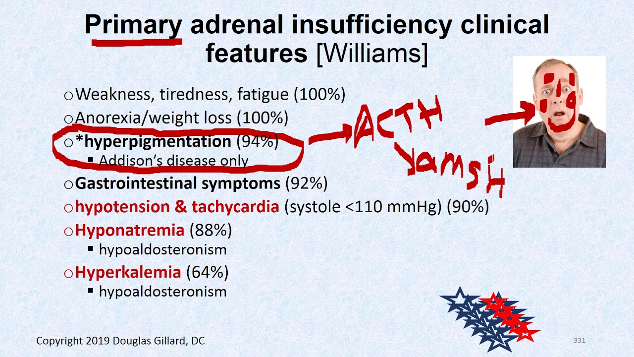 Endocrinology:(Wk5)(Tues)(Spr20): Primary and Secondary Adrenal Insufficiency (Part II)