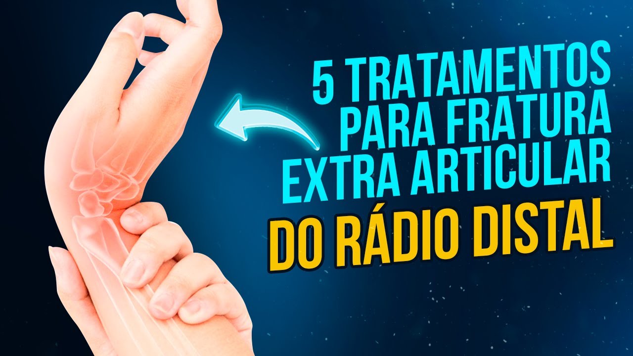 5 TRATAMENTOS PARA FRATURA EXTRA ARTICULAR DO RÁDIO DISTAL | QUAL É O MELHOR?