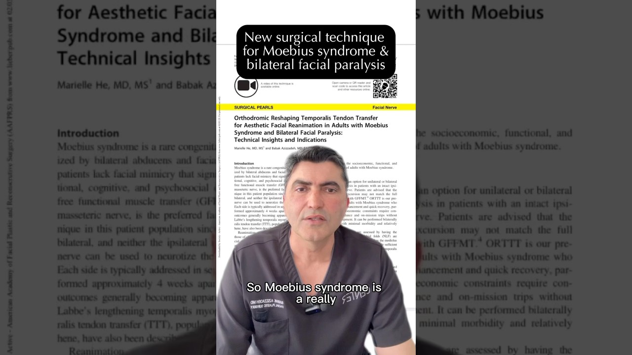 New surgical technique for Moebius syndrome & bilateral facial paralysis