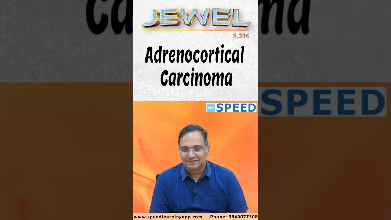 Adrenocortical carcinoma by Dr.K.Vinayak Senthil., 