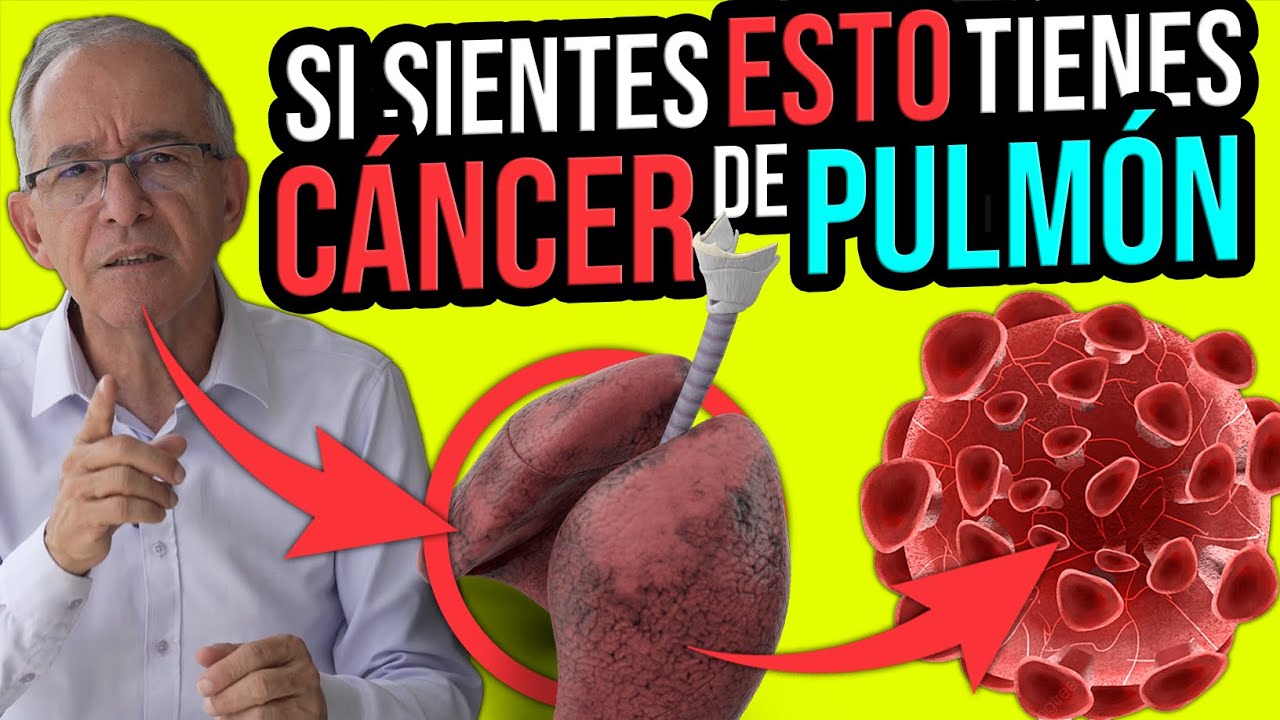 CUIDADO SI SIENTES ESTO TIENES  CÁNCER DE PULMÓN - Oswaldo Restrepo RSC