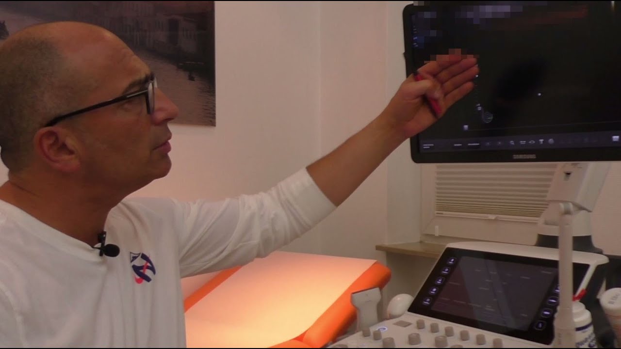 Diagnostik der Mammaimplantatruptur mittels Ultraschall - Robinson Frauenmedizin