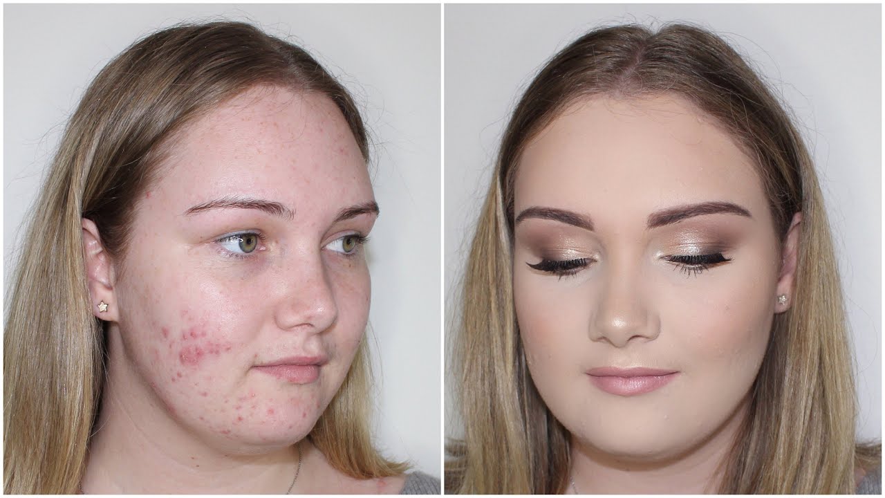 Acne Coverage Client Tutorial ♡ Jasmine Hand