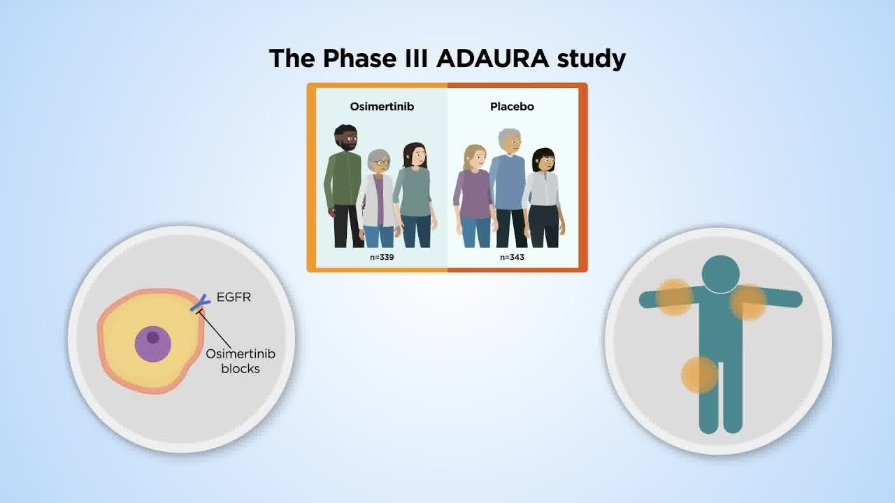 Analysis of patients&rsquo; side effects and quality of life in the ADAURA study